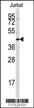 PTPN7 Antibody (S44)