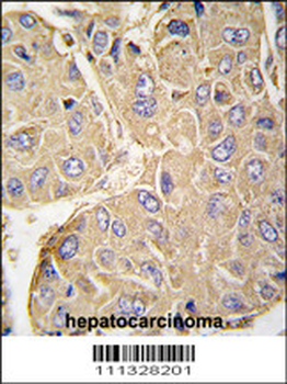 PTPN7 Antibody (S44)
