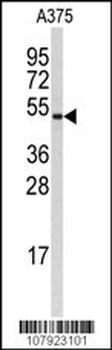 Cyclin B1 Antibody (S126)