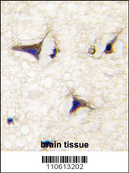 DAAM2 Antibody (N-term)
