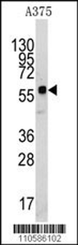 KREMEN1 Antibody (N-term)