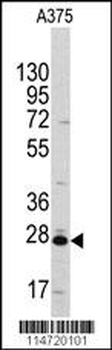 CLIC1 Antibody
