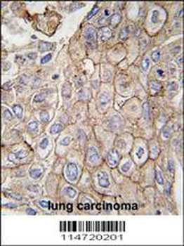 CLIC1 Antibody