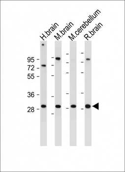CABP1 Antibody (C-term)