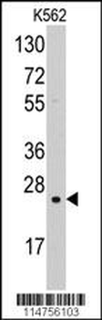 SOD2 Antibody