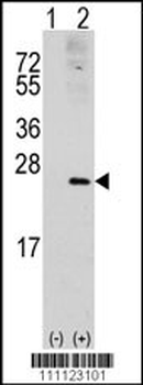 RAC1 Antibody (S71)