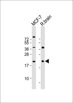 RAC1 Antibody (S71)