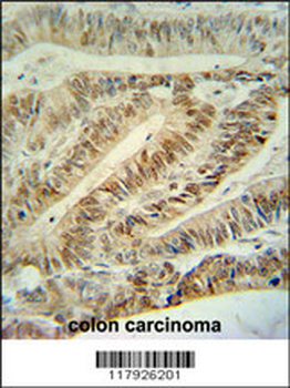 CUL5 Antibody (C-term)