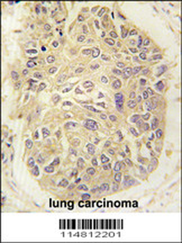 FARSA Antibody (N-term)