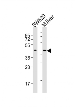 ACAT1 Antibody (C-term)