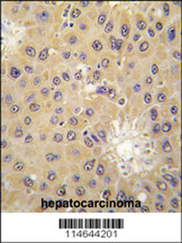 ACAT1 Antibody (C-term)