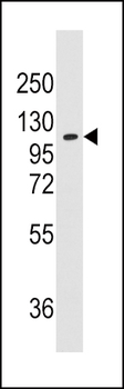 AlaRS (AARS) Antibody (N-term)