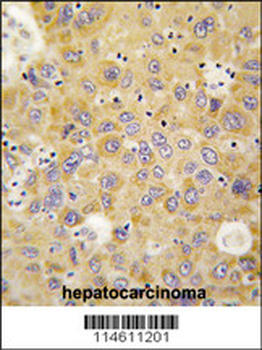 AlaRS (AARS) Antibody (N-term)