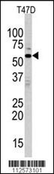 MAPK15 Antibody (N-term)
