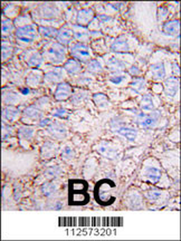 MAPK15 Antibody (N-term)