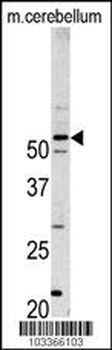 PFTK1 Antibody (N-term)