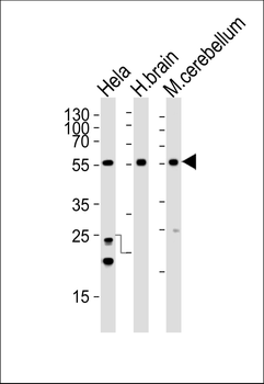 PFTK1 Antibody (N-term)