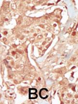 PCTAIRE3 (PCTK3) Antibody (N-term)