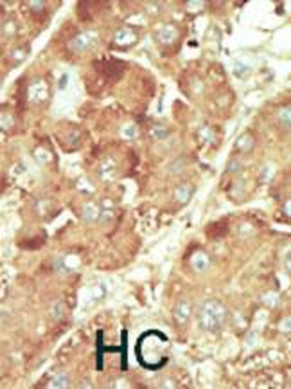 NLK Antibody (C-term)