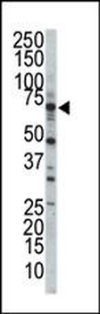 STK23 (MSSK1) Antibody (Center)
