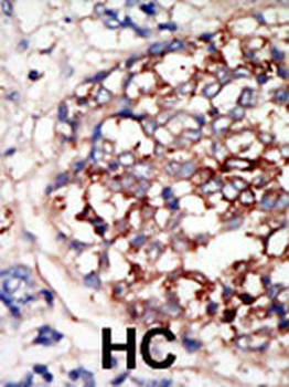 DYRK1B Antibody (C-term)