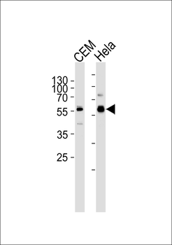 DYRK2 Antibody (N-term)