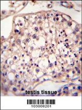 DYRK2 Antibody (N-term)