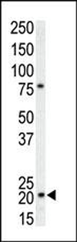p21 (CDKN1A) Antibody (C-term)