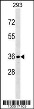 CDKL1 Antibody (C-term)