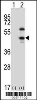 CDKL1 Antibody (C-term)