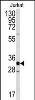 CDK2 Antibody (C-term)