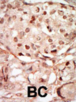CDK10 Antibody (N-term)