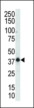 MAPK12 Antibody (C-term)