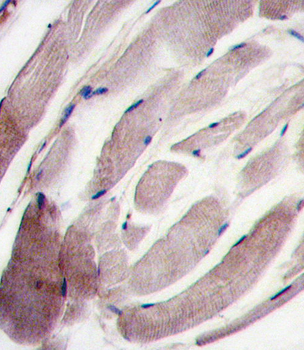 MAPK12 Antibody (C-term)