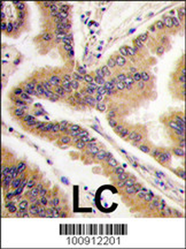 MAPK13 Antibody (C-term)