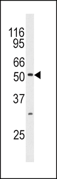 MAPK10 Antibody (N-term)
