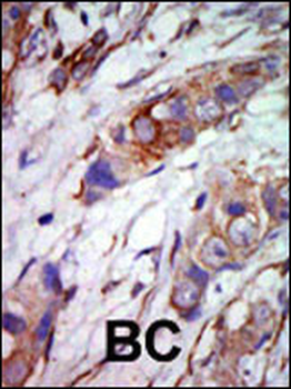 MAPK7 Antibody (C-term)