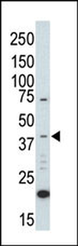 MAPK1 Antibody (C-term)