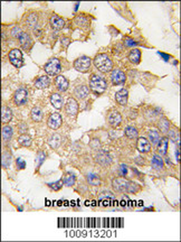 MAPK1 Antibody (C-term)