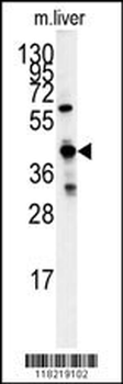 GCAT Antibody (Center)