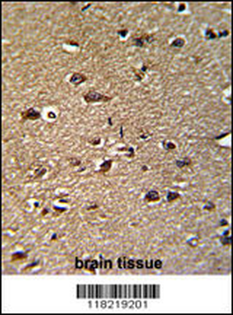 GCAT Antibody (Center)