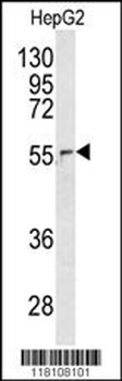 NUP62 Antibody (C-term E507)