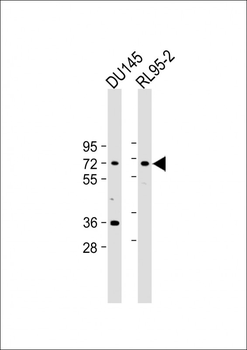 DDX53 Antibody (C-term)
