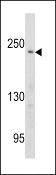 PCM-1 Antibody (Center)