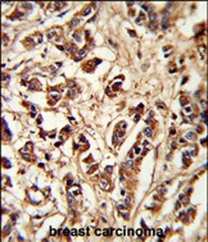 PCM-1 Antibody (Center)