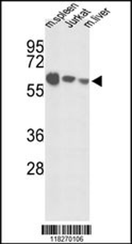 IGFALS Antibody (Center)