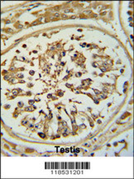 OPLAH Antibody (N-term)