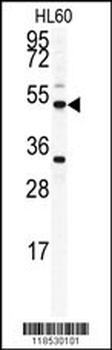 OMD Antibody (C-term)