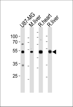 GPT Antibody (N-term R133)