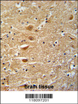 KIF3C Antibody (C-term)